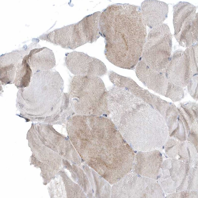 CACNB2 Antibody - BSA Free Immunohistochemistry-Paraffin: CACNB2 Antibody [NBP1-86680]