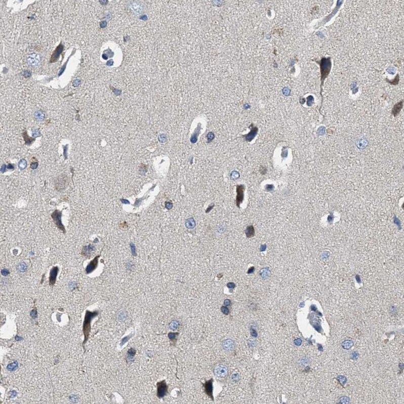 Cav1.3 Antibody - BSA Free Immunohistochemistry-Paraffin: Cav1.3 Antibody - BSA Free [NBP1-86684]