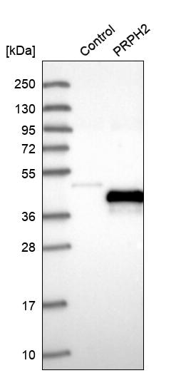 Peripherin 2/PRPH2 Antibody - BSA Free Western Blot: Peripherin 2/PRPH2 Antibody - BSA Free [NBP1-86687]