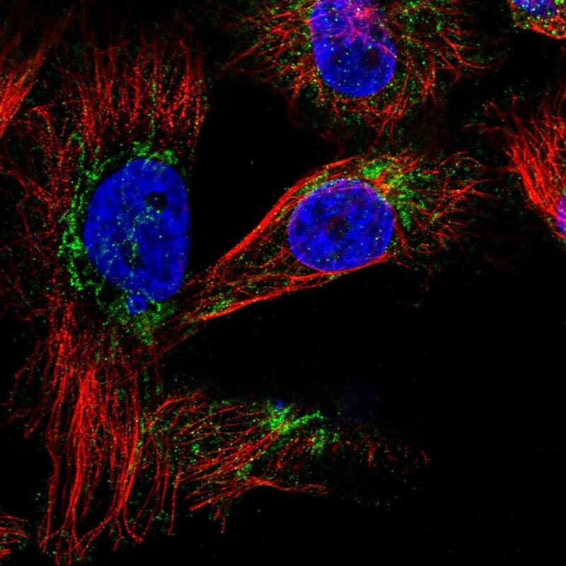 SLC25A20 Antibody - BSA Free Immunocytochemistry/ Immunofluorescence: SLC25A20 Antibody [NBP1-86689]