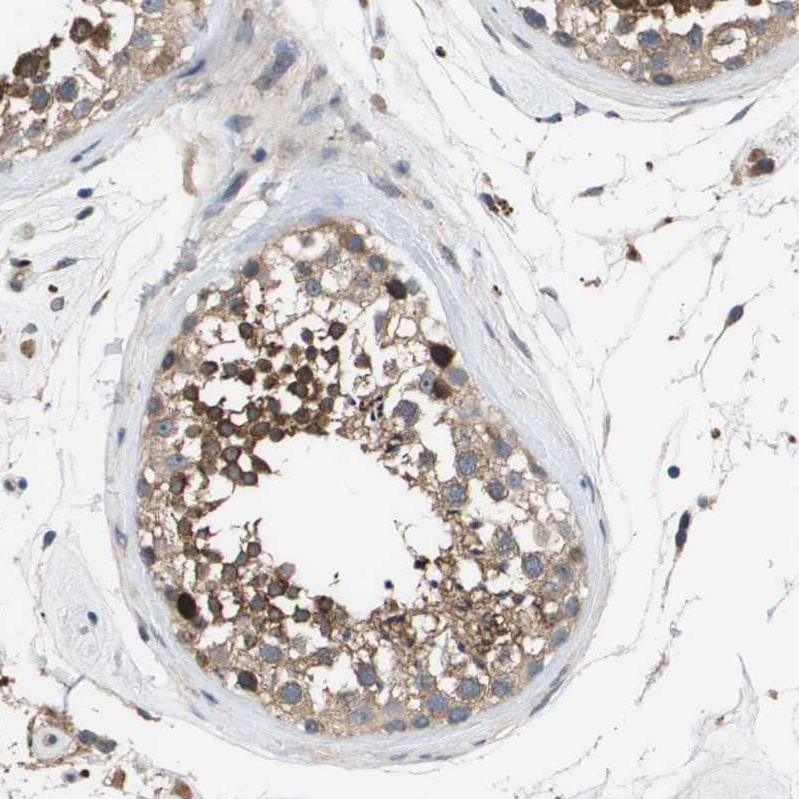 SLC25A20 Antibody - BSA Free Immunohistochemistry-Paraffin: SLC25A20 Antibody [NBP1-86690]