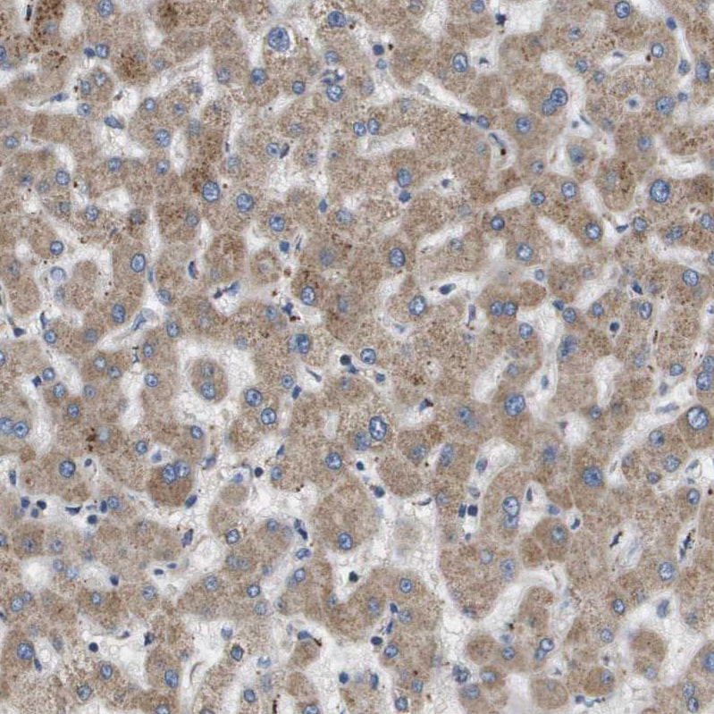 SLC25A20 Antibody - BSA Free Immunohistochemistry-Paraffin: SLC25A20 Antibody [NBP1-86690]