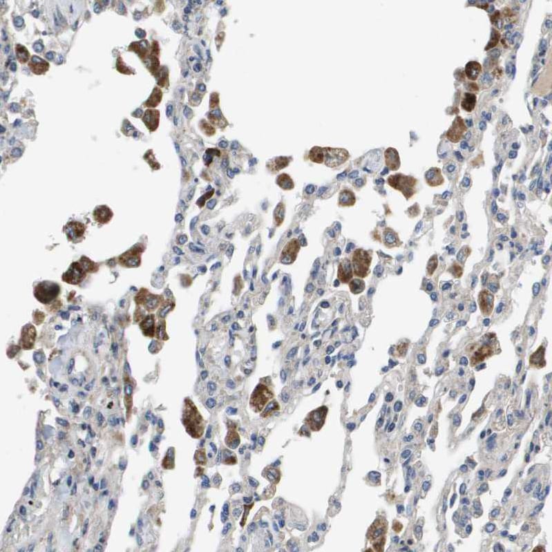 SLC25A20 Antibody - BSA Free Immunohistochemistry-Paraffin: SLC25A20 Antibody [NBP1-86690]