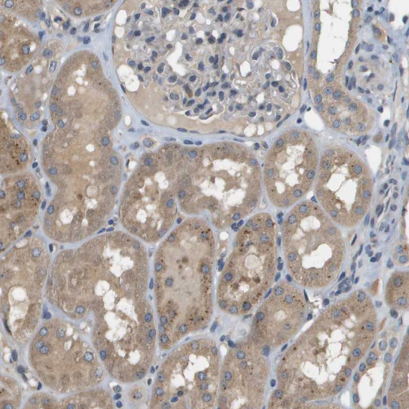 SLC25A20 Antibody - BSA Free Immunohistochemistry-Paraffin: SLC25A20 Antibody [NBP1-86690]