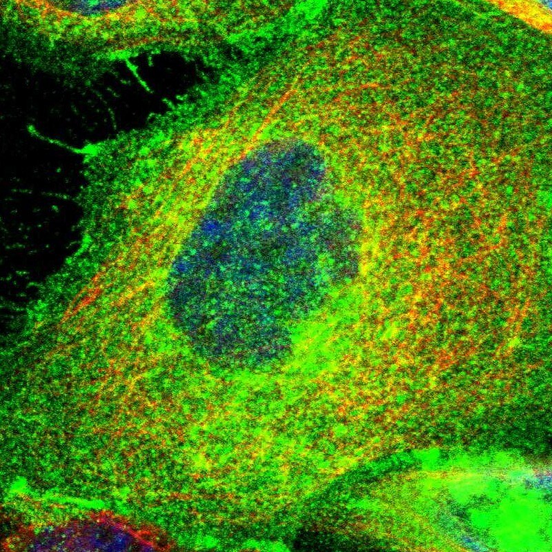 PGAP3 Antibody - BSA Free Immunohistochemistry-Paraffin: PGAP3 Antibody - BSA Free [NBP1-86692]