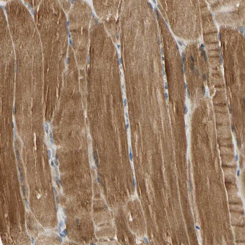NPDC-1 Antibody - BSA Free Immunohistochemistry-Paraffin: NPDC-1 Antibody - BSA Free [NBP1-86693]