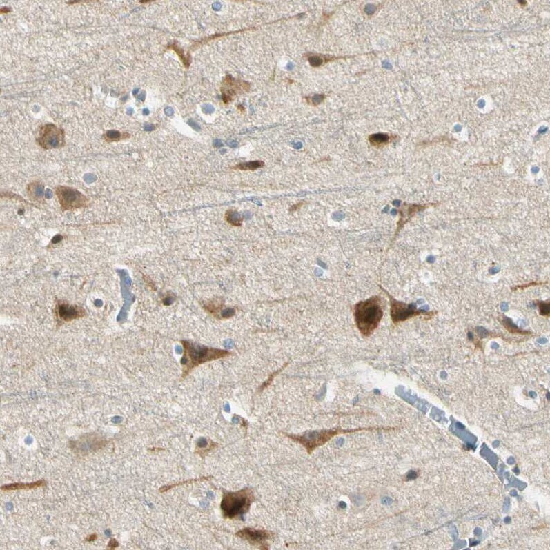 NPDC-1 Antibody - BSA Free Immunohistochemistry-Paraffin: NPDC-1 Antibody - BSA Free [NBP1-86693]