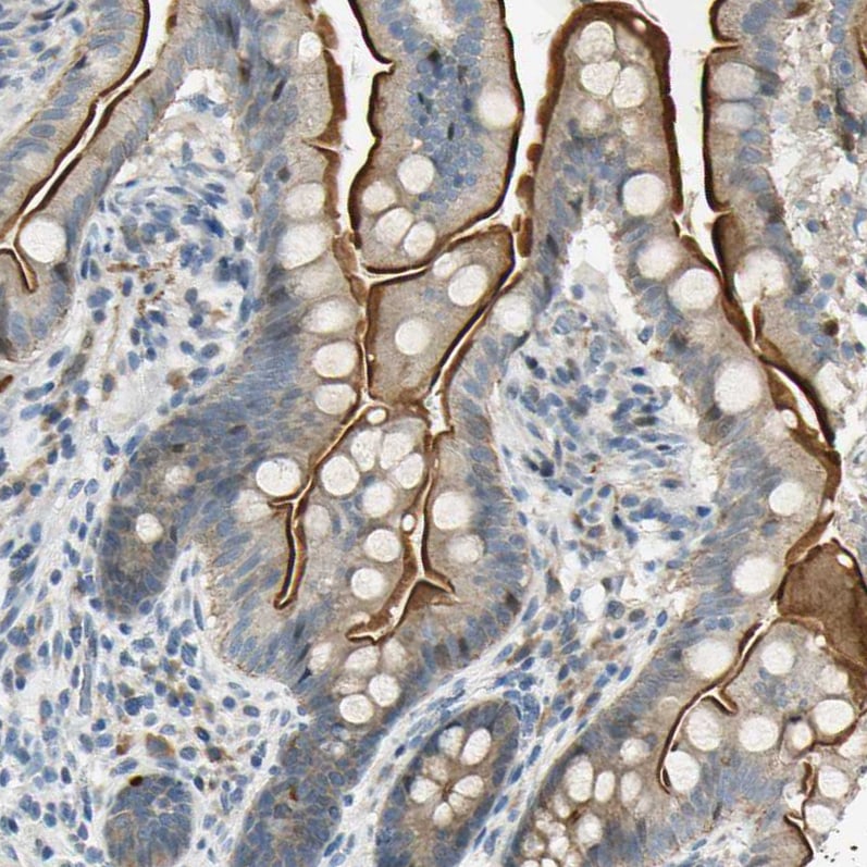 NPDC-1 Antibody - BSA Free Immunohistochemistry-Paraffin: NPDC-1 Antibody - BSA Free [NBP1-86693]