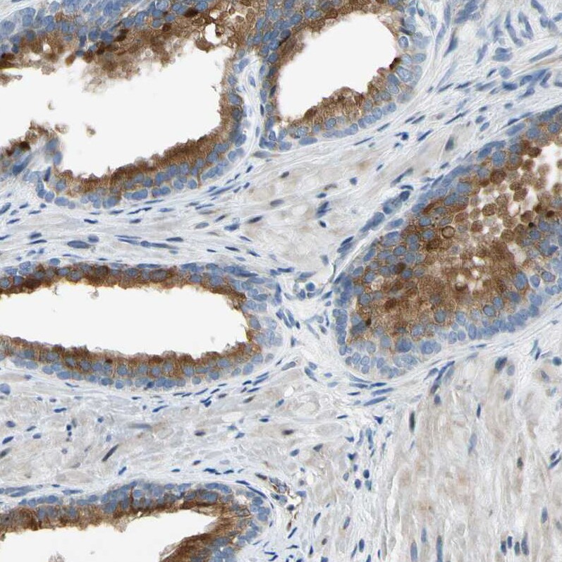 NPDC-1 Antibody - BSA Free Immunohistochemistry-Paraffin: NPDC-1 Antibody - BSA Free [NBP1-86693]