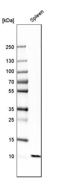 EN-RAGE/S100A12 Antibody - BSA Free Western Blot: EN-RAGE/S100A12 Antibody - BSA Free [NBP1-86694]