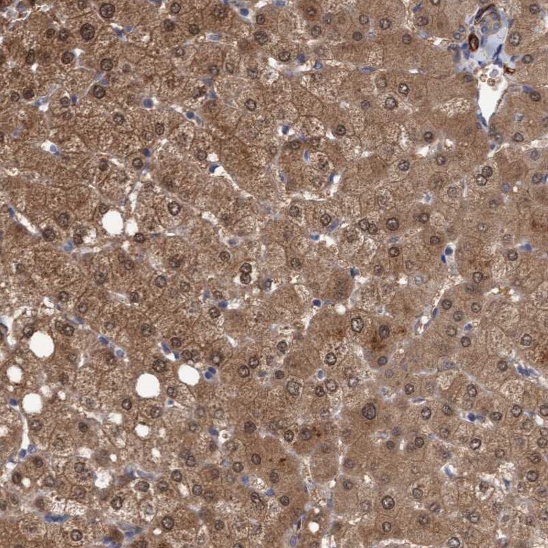 TSTD2 Antibody - BSA Free Immunohistochemistry-Paraffin: TSTD2 Antibody - BSA Free [NBP1-86696]