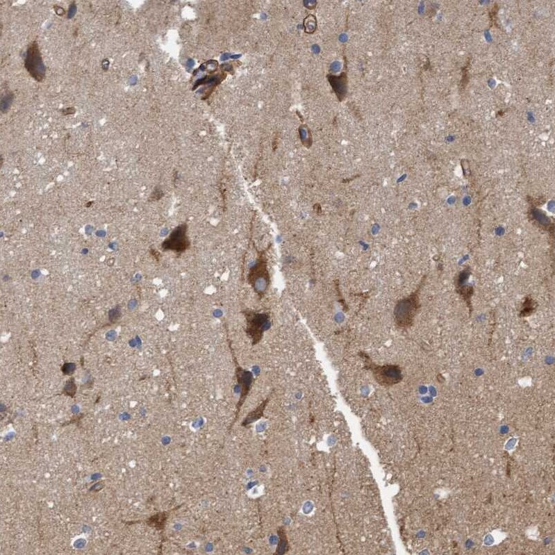 TSTD2 Antibody - BSA Free Immunohistochemistry-Paraffin: TSTD2 Antibody - BSA Free [NBP1-86696]