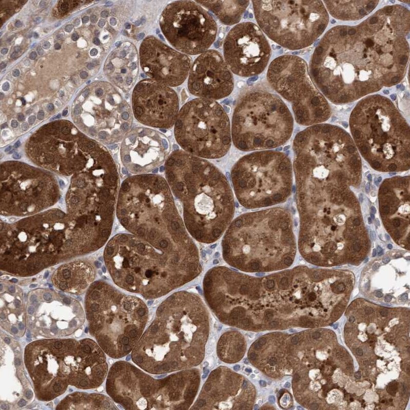 TSTD2 Antibody - BSA Free Immunohistochemistry-Paraffin: TSTD2 Antibody - BSA Free [NBP1-86696]