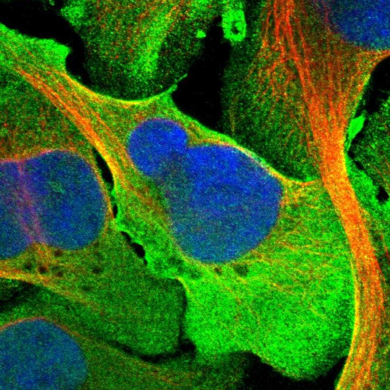 TPRN Antibody Immunocytochemistry/ Immunofluorescence: TPRN Antibody [NBP1-86697]