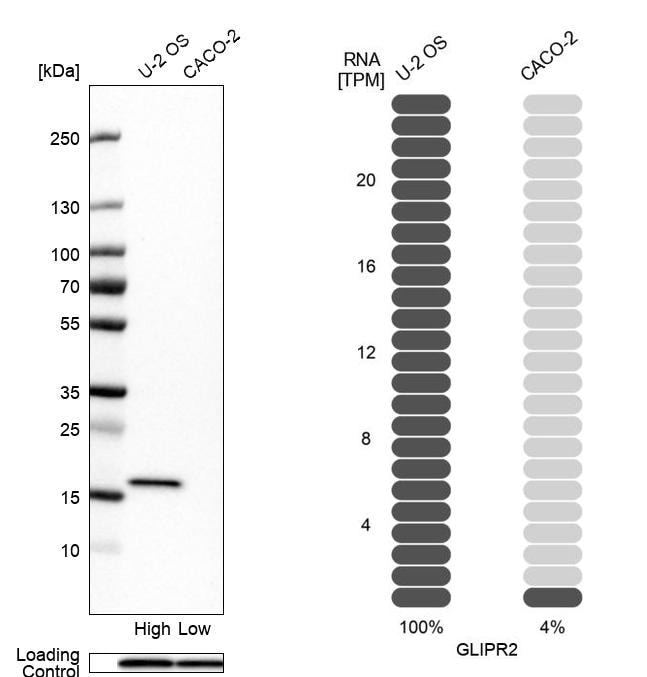 GLIPR2 Antibody - BSA Free Western Blot: GLIPR2 Antibody - BSA Free [NBP1-86703]
