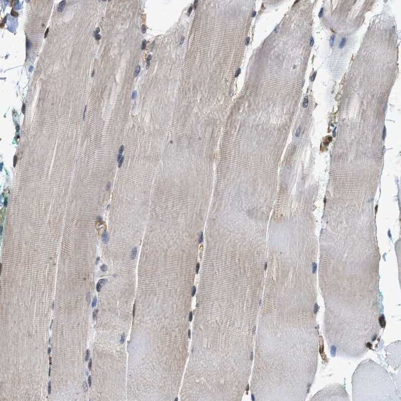 SCAI Antibody - BSA Free Immunohistochemistry-Paraffin: SCAI Antibody - BSA Free [NBP1-86711]