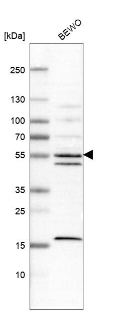 IPPK Antibody - BSA Free Western Blot: IPPK Antibody - BSA Free [NBP1-86712]