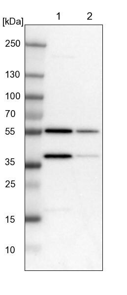 FAM110B Antibody - BSA Free Western Blot: FAM110B Antibody - BSA Free [NBP1-86720]