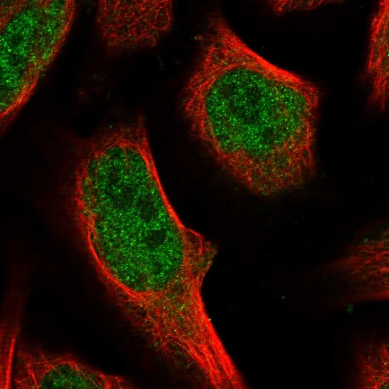 wdyhv1 Antibody - BSA Free Immunohistochemistry-Paraffin: wdyhv1 Antibody - BSA Free [NBP1-86722]
