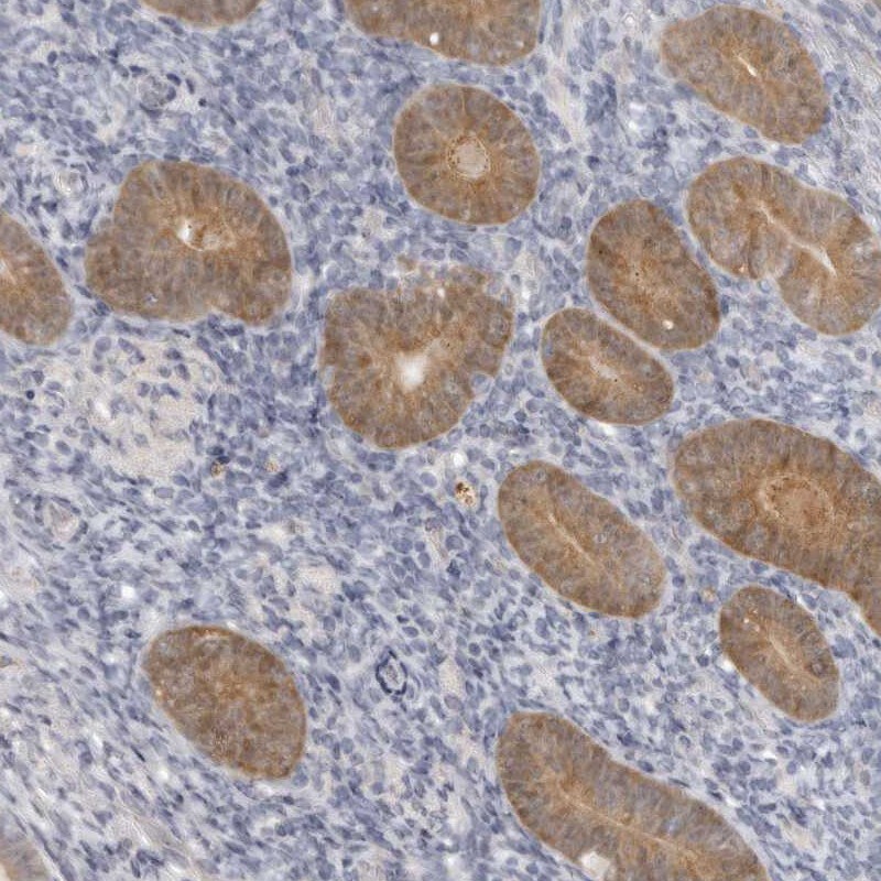 gamma-Glutamylcyclotransferase/CRF21/GGCT Antibody - BSA Free Immunohistochemistry-Paraffin: gamma-Glutamylcyclotransferase/CRF21/GGCT Antibody [NBP1-86727]
