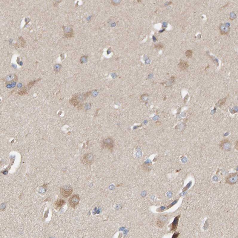 CCM2 Antibody - BSA Free Immunohistochemistry-Paraffin: CCM2 Antibody [NBP1-86729]