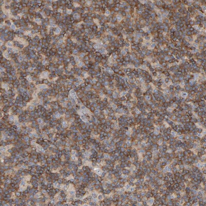 CCM2 Antibody - BSA Free Immunohistochemistry-Paraffin: CCM2 Antibody [NBP1-86729]