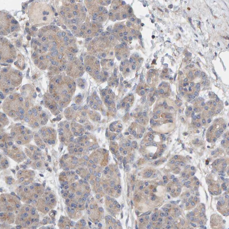 CCM2 Antibody - BSA Free Immunohistochemistry-Paraffin: CCM2 Antibody [NBP1-86729]