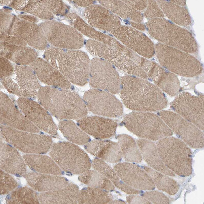 CCM2 Antibody - BSA Free Immunohistochemistry-Paraffin: CCM2 Antibody [NBP1-86729]