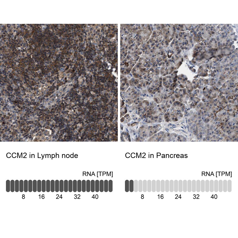 CCM2 Antibody - BSA Free Immunohistochemistry-Paraffin: CCM2 Antibody [NBP1-86730]