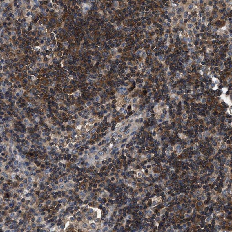 CCM2 Antibody - BSA Free Immunohistochemistry-Paraffin: CCM2 Antibody [NBP1-86730]