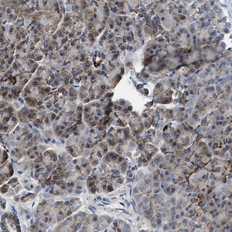 CCM2 Antibody - BSA Free Immunohistochemistry-Paraffin: CCM2 Antibody [NBP1-86730]