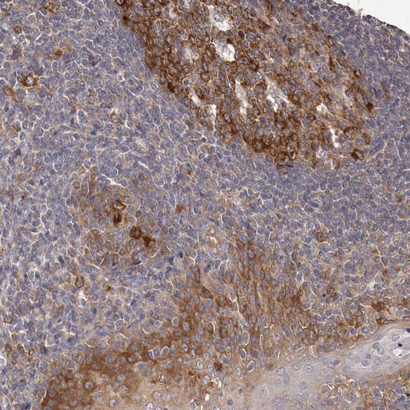 LTV1 Antibody - BSA Free Immunohistochemistry-Paraffin: LTV1 Antibody - BSA Free [NBP1-86734]