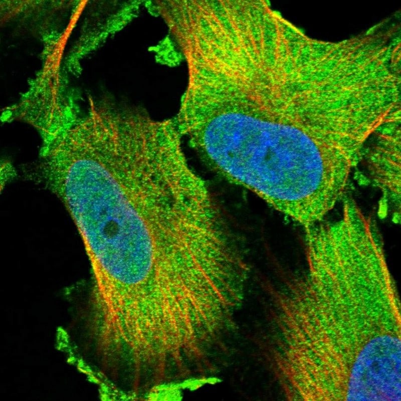 LTV1 Antibody - BSA Free Immunocytochemistry/ Immunofluorescence: LTV1 Antibody [NBP1-86735]
