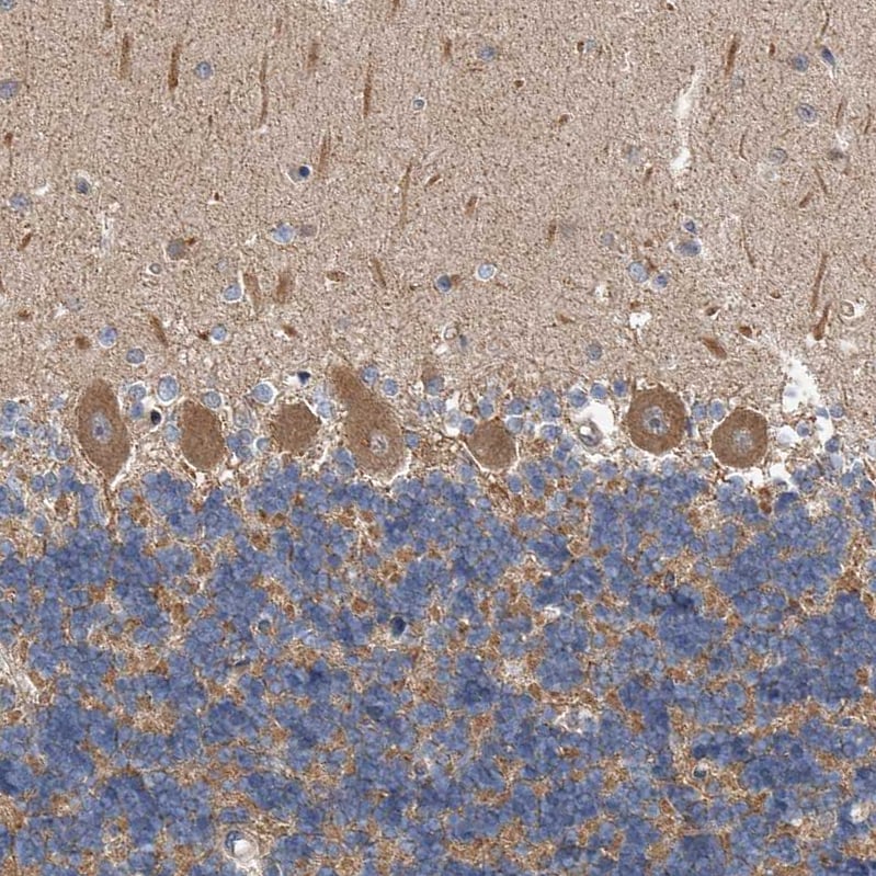 LTV1 Antibody - BSA Free Immunohistochemistry-Paraffin: LTV1 Antibody - BSA Free [NBP1-86735]