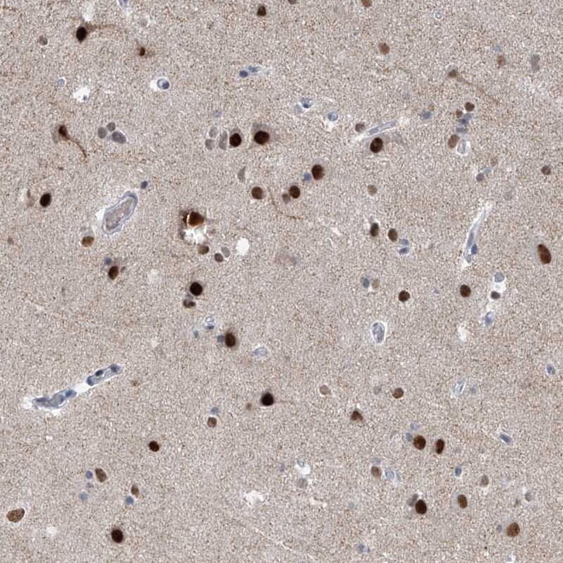 MCM9 Antibody - BSA Free Immunohistochemistry-Paraffin: MCM9 Antibody - BSA Free [NBP1-86740]