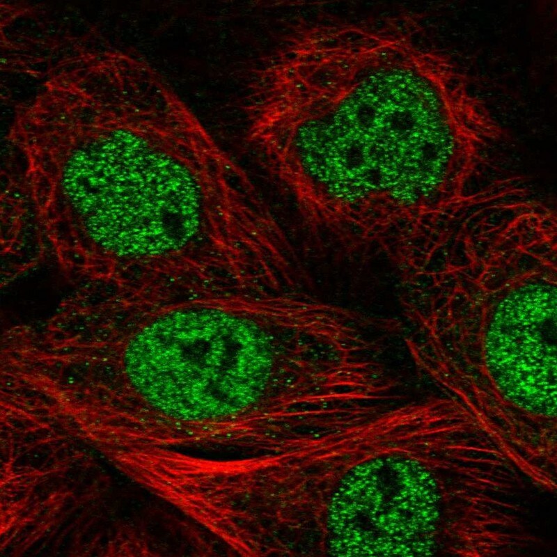 MCM9 Antibody - BSA Free Immunohistochemistry-Paraffin: MCM9 Antibody - BSA Free [NBP1-86740]