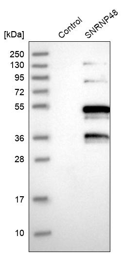 SNRNP48 Antibody - BSA Free Western Blot: SNRNP48 Antibody - BSA Free [NBP1-86760]