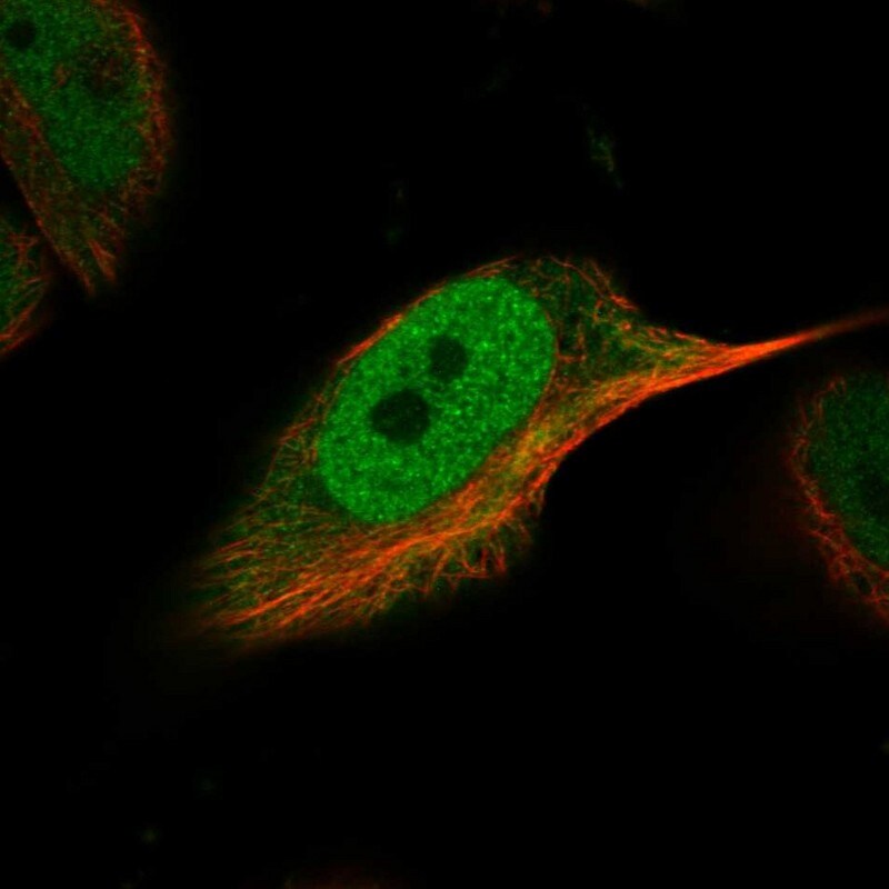 SNRNP48 Antibody - BSA Free Immunohistochemistry-Paraffin: SNRNP48 Antibody - BSA Free [NBP1-86760]