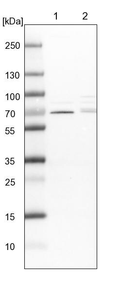 CDK5RAP3 Antibody - BSA Free Western Blot: CDK5RAP3 Antibody - BSA Free [NBP1-86779]