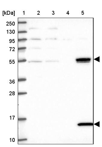 UFSP2 Antibody - BSA Free Western Blot: UFSP2 Antibody - BSA Free [NBP1-86781]