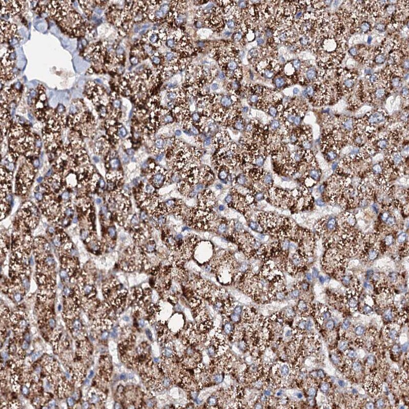 SLC10A7 Antibody - BSA Free Immunohistochemistry-Paraffin: SLC10A7 Antibody - BSA Free [NBP1-86784]