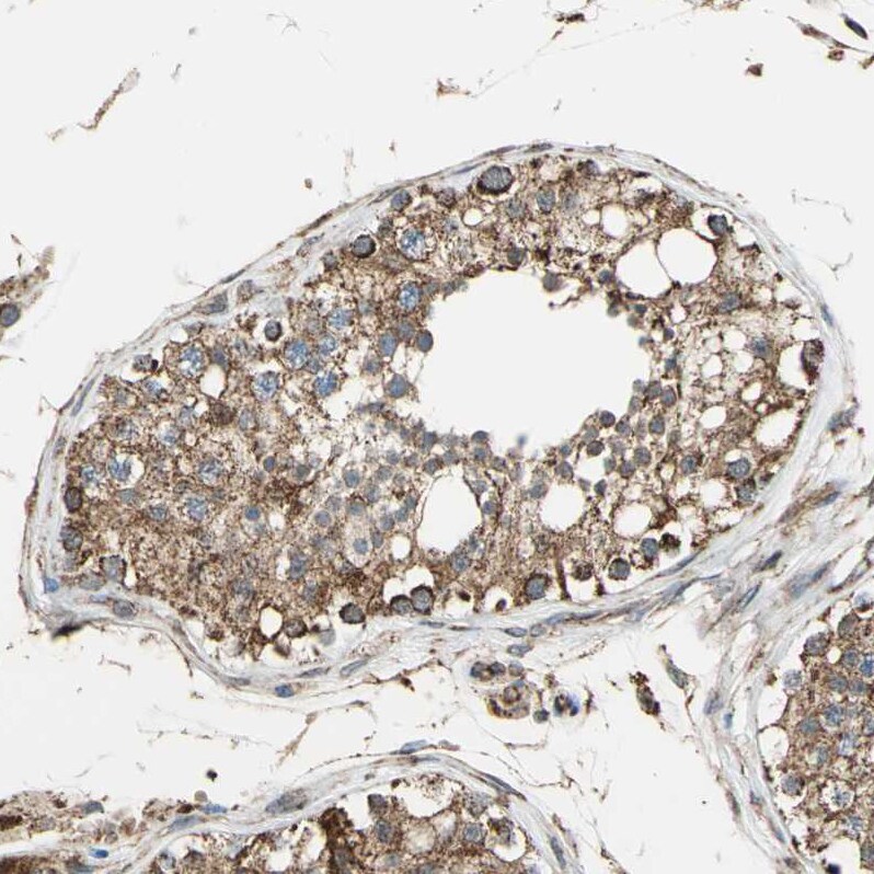 MRPS22 Antibody - BSA Free Immunohistochemistry-Paraffin: MRPS22 Antibody - BSA Free [NBP1-86787]