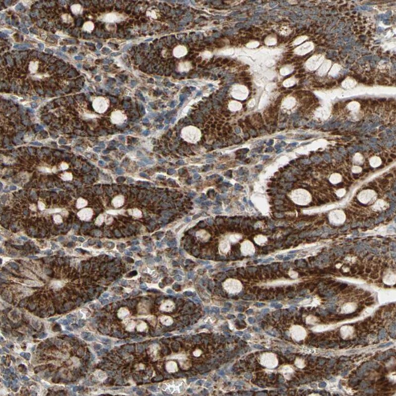 MRPS22 Antibody - BSA Free Immunohistochemistry-Paraffin: MRPS22 Antibody - BSA Free [NBP1-86787]