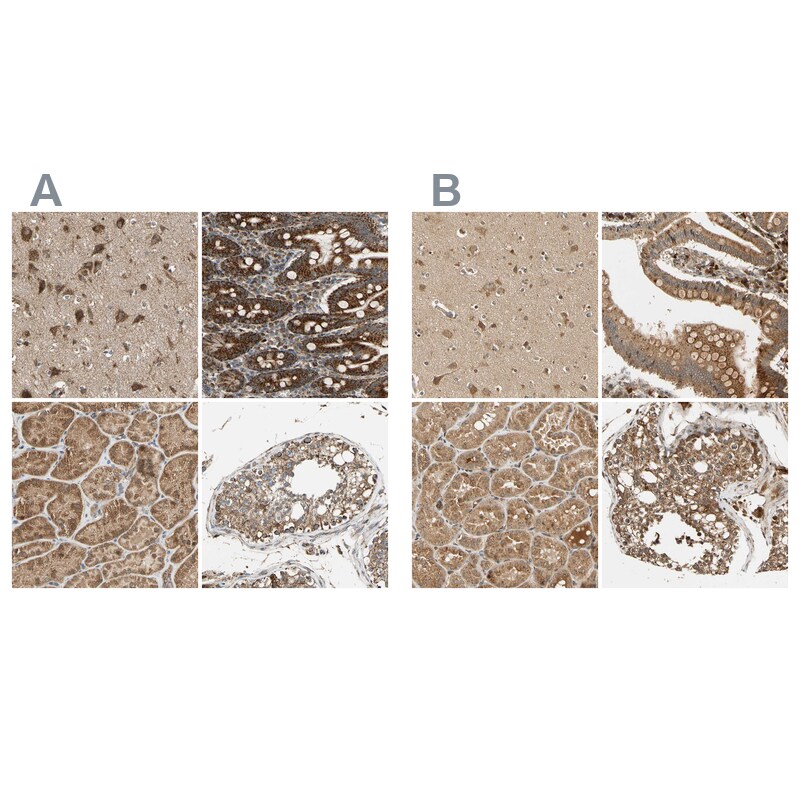 MRPS22 Antibody - BSA Free Immunohistochemistry-Paraffin: MRPS22 Antibody - BSA Free [NBP1-86787]