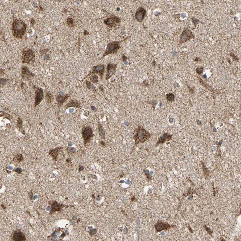 MRPS22 Antibody - BSA Free Immunohistochemistry-Paraffin: MRPS22 Antibody - BSA Free [NBP1-86787]