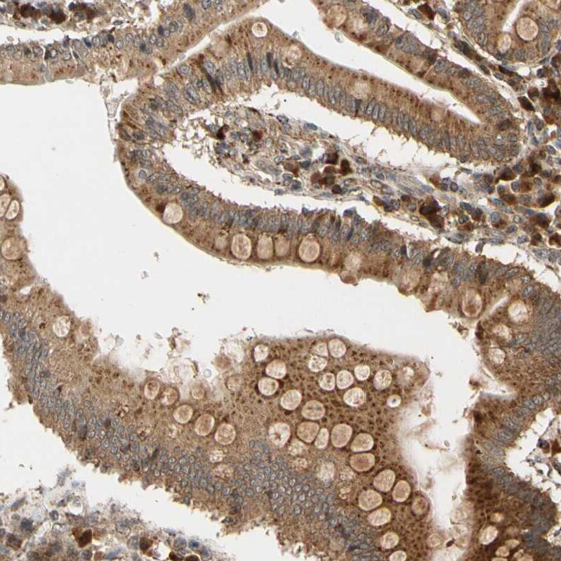 MRPS22 Antibody - BSA Free Immunohistochemistry-Paraffin: MRPS22 Antibody - BSA Free [NBP1-86788]
