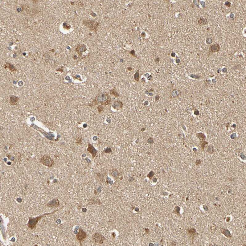 MRPS22 Antibody - BSA Free Immunohistochemistry-Paraffin: MRPS22 Antibody - BSA Free [NBP1-86788]