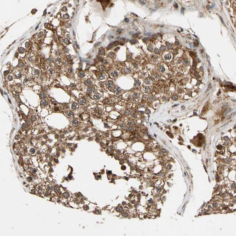 MRPS22 Antibody - BSA Free Immunohistochemistry-Paraffin: MRPS22 Antibody - BSA Free [NBP1-86788]