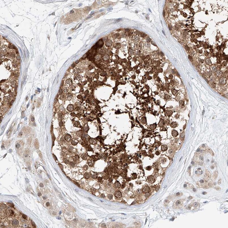 CLDND1 Antibody - BSA Free Immunohistochemistry-Paraffin: CLDND1 Antibody [NBP1-86790]