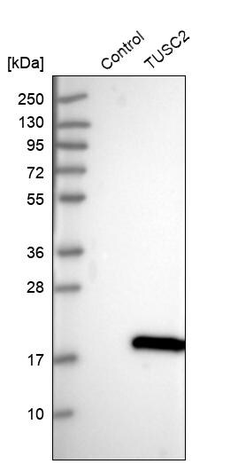 TUSC2 Antibody - BSA Free Western Blot: TUSC2 Antibody - BSA Free [NBP1-86794]